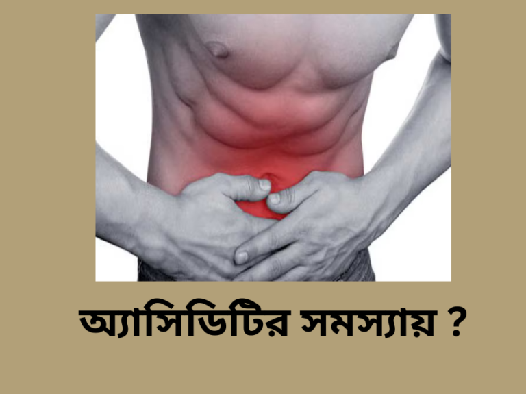 অ্যাসিডিটির সমস্যায় সহজ ঘরোয়া টিপস